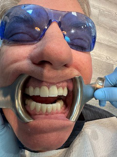 Before and After - Case 1