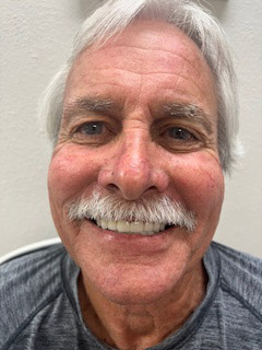 Before and After - Case 3 Before and After - Case 3